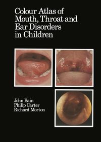 Produktbild: Colour Atlas of Mouth, Throat and Ear Disorders in Children