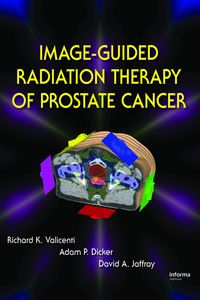 Produktbild: Image-Guided Radiation Therapy of Prostate Cancer