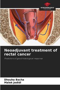 Produktbild: Neoadjuvant treatment of rectal cancer