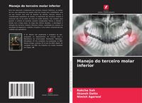 Produktbild: Manejo do terceiro molar inferior