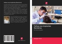 Produktbild: Falhas nos Implantes Dent&aacute;rios