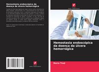 Produktbild: Hemostasia endosc&oacute;pica da doen&ccedil;a da &uacute;lcera hemorr&aacute;gica