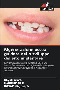 Produktbild: Rigenerazione ossea guidata nello sviluppo del sito implantare