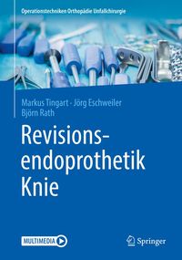 Produktbild: Revisionsendoprothetik Knie
