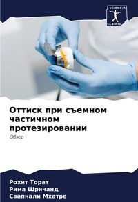 Produktbild: Ottisk pri s#emnom chastichnom protezirowanii