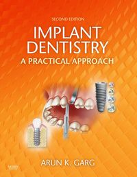 Produktbild: Implant Dentistry - E-Book