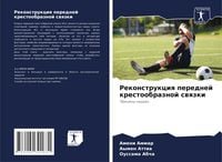 Produktbild: Rekonstrukciq perednej krestoobraznoj swqzki