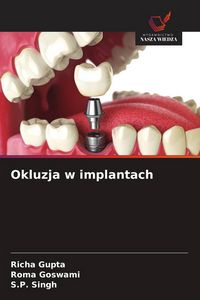 Produktbild: Okluzja w implantach