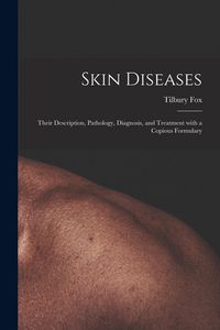 Produktbild: Skin Diseases [electronic Resource]: Their Description, Pathology, Diagnosis, and Treatment With a Copious Formulary