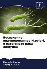 Produktbild: Vospalenie, inducirowannoe H.pylori, w patogeneze raka zheludka