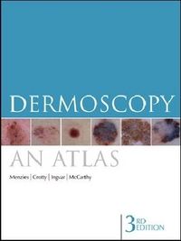Produktbild: Menzies, S: Dermoscopy: An Atlas