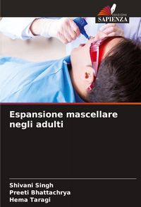 Produktbild: Espansione mascellare negli adulti