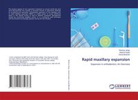 Produktbild: Rapid maxillary expansion