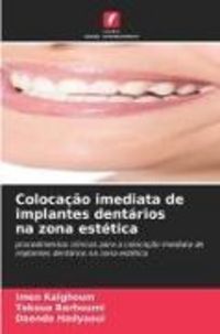 Produktbild: Coloca&ccedil;&atilde;o imediata de implantes dent&aacute;rios na zona est&eacute;tica