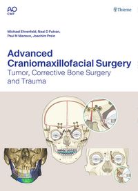 Produktbild: Advanced Craniomaxillofacial Surgery