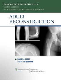 Produktbild: Adult Reconstruction