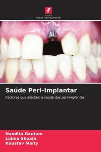 Produktbild: Sa&uacute;de Peri-Implantar