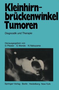 Produktbild: Kleinhirnbr&uuml;ckenwinkel-Tumoren