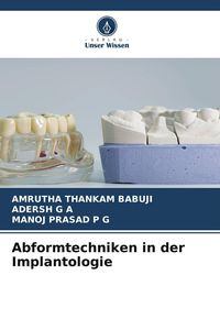 Produktbild: Abformtechniken in der Implantologie