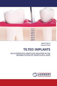Produktbild: Tilted Implants