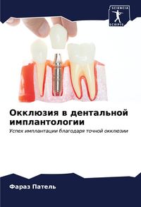 Produktbild: Okkl&uuml;ziq w dental'noj implantologii