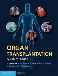 Produktbild: Organ Transplantation