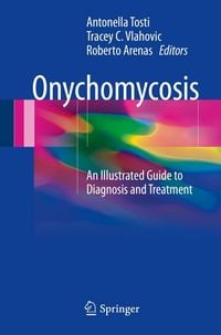 Produktbild: Onychomycosis