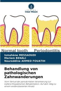 Produktbild: Behandlung von pathologischen Zahnwanderungen
