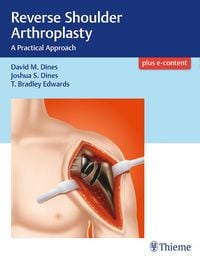 Produktbild: Reverse Shoulder Arthroplasty