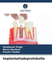 Produktbild: Implantatladeprotokolle