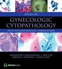 Produktbild: Vandenbussche, C: Atlas of Gynecologic Cytopathology