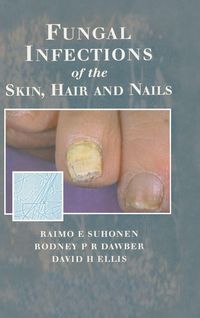 Produktbild: Fungal Infections of the Skin and Nails
