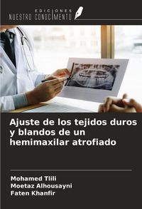 Produktbild: Ajuste de los tejidos duros y blandos de un hemimaxilar atrofiado