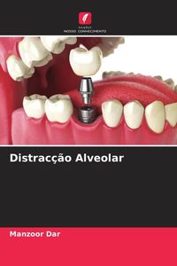 Produktbild: Distrac&ccedil;&atilde;o Alveolar