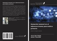 Produktbild: Gemaci&oacute;n tumoral en el adenocarcinoma pancre&aacute;tico primario