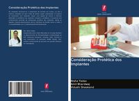 Produktbild: Considera&ccedil;&atilde;o Prot&eacute;tica dos Implantes