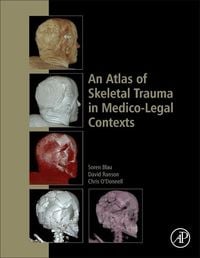 Bild vom Artikel An Atlas of Skeletal Trauma in Medico-Legal Contexts vom Autor Soren Blau