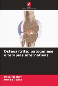 Produktbild: Osteoartrite: patog&eacute;nese e terapias alternativas