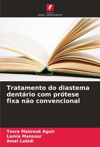 Produktbild: Tratamento do diastema dent&aacute;rio com pr&oacute;tese fixa n&atilde;o convencional