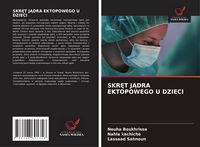 Produktbild: Skr&iquest;t J&iquest;dra Ektopowego U Dzieci