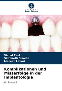 Produktbild: Komplikationen und Misserfolge in der Implantologie