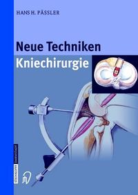 Bild vom Artikel Neue Techniken Kniechirurgie vom Autor H.H. Pässler
