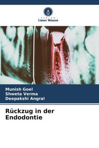 Produktbild: R&uuml;ckzug in der Endodontie