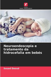 Produktbild: Neuroendoscopia e tratamento da hidrocefalia em beb&eacute;s