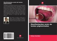 Produktbild: Manifesta&ccedil;&otilde;es orais de les&otilde;es pigmentadas