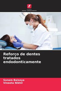 Produktbild: Refor&ccedil;o de dentes tratados endodonticamente