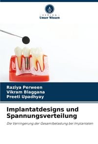Produktbild: Implantatdesigns und Spannungsverteilung