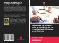 Produktbild: Implantes Inclinados para a Reabilita&ccedil;&atilde;o de Mand&iacute;bulas Ed&ecirc;ntulas - uma Revis&atilde;o