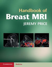 Produktbild: Handbook of Breast MRI