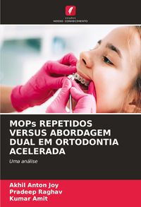 Produktbild: Mops Repetidos Versus Abordagem Dual Em Ortodontia Acelerada